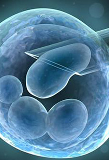 D套餐 普通助孕托管46万